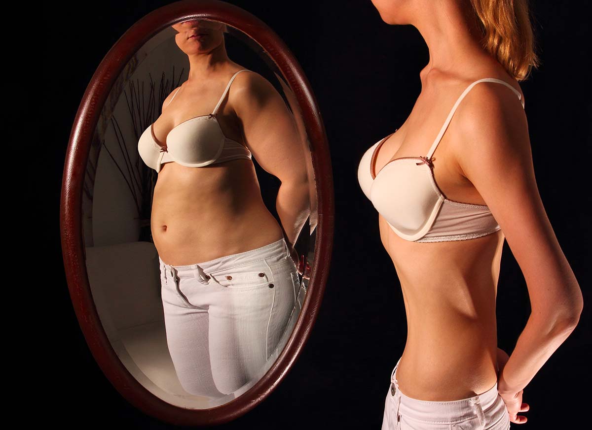 RICOVERO PER ANORESSIA NERVOSA